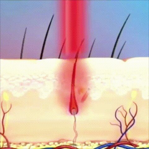 1664361394181546.gif gif2.gif